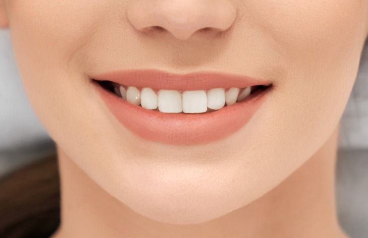 denti bianchissimi curcuma
